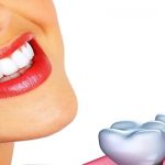 Why Your Jawbone Influences Your Suitability For Dental Implants